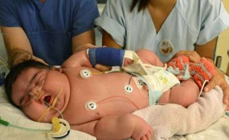 رکورد چاق‌ترین نوزادان دنیا /عکس
