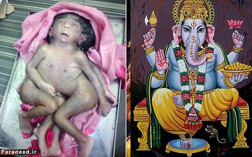 پرستش یک کودک ناقص الخلقه در هند!!!/عکس