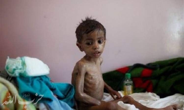 هشدار سازمان ملل درباره خطر قحطی مجدد در یمن